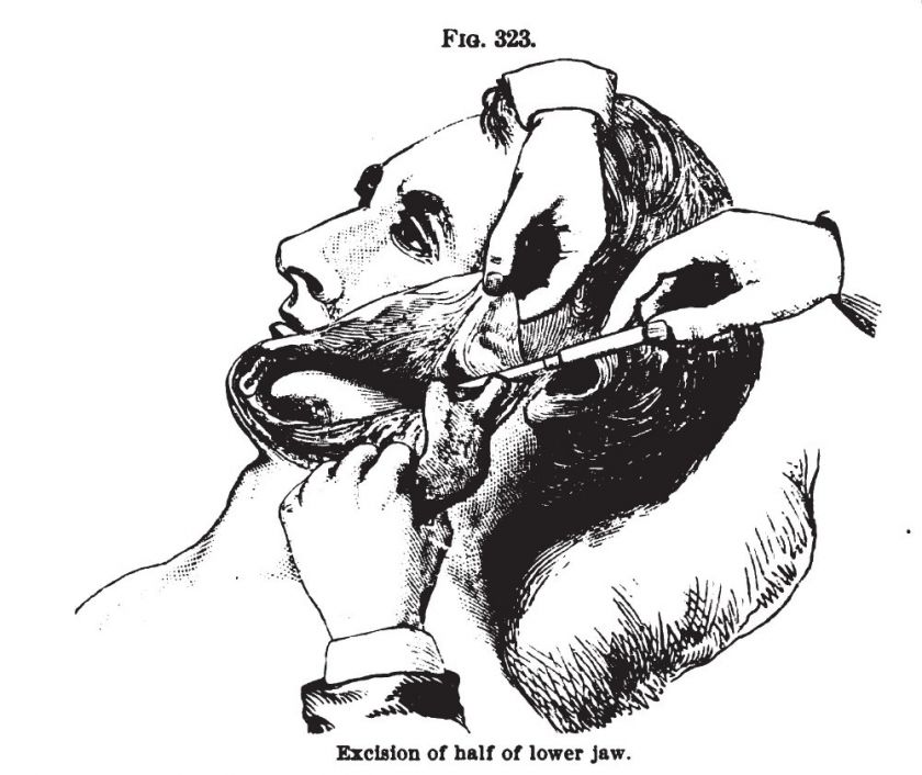 14 old books SURGERY medical surgical techniques v1  